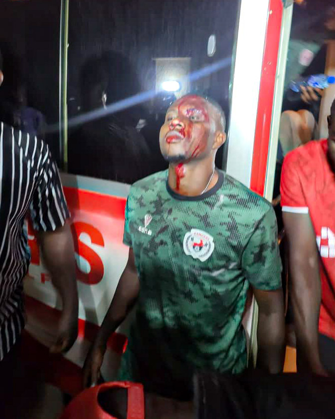 Read more about the article Rangers Intl Players Attacked by Angry Fans