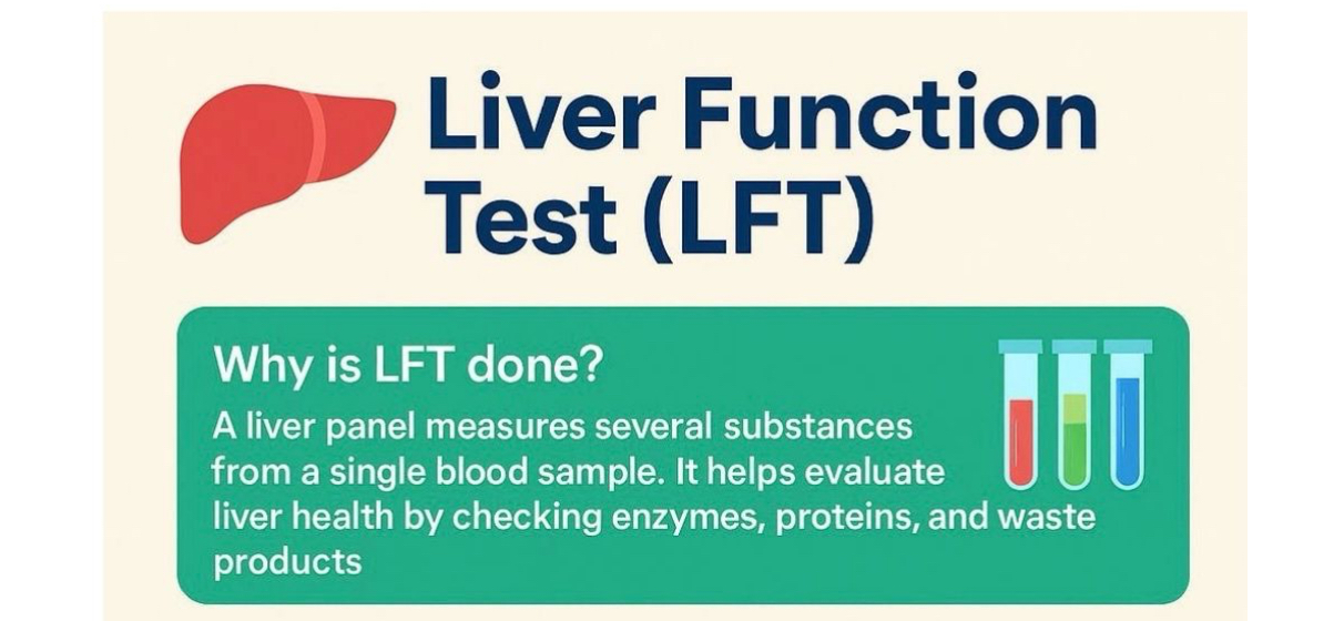 Read more about the article 🧪 Liver Function Test (LFT) – A Key Diagnostic Tool in Clinical Practice — Shahid Nisar (Linkin)
